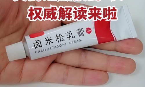 玫瑰康症只用口服药用吗网 :分享玫瑰康用什么药膏-玫瑰康症吃什么药知识